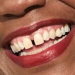 whatsapp image 2024 08 13 at 11.56.48 150x150 (1)