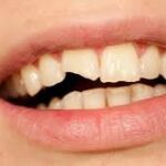 whatsapp image 2024 08 13 at 11.57.55 150x150